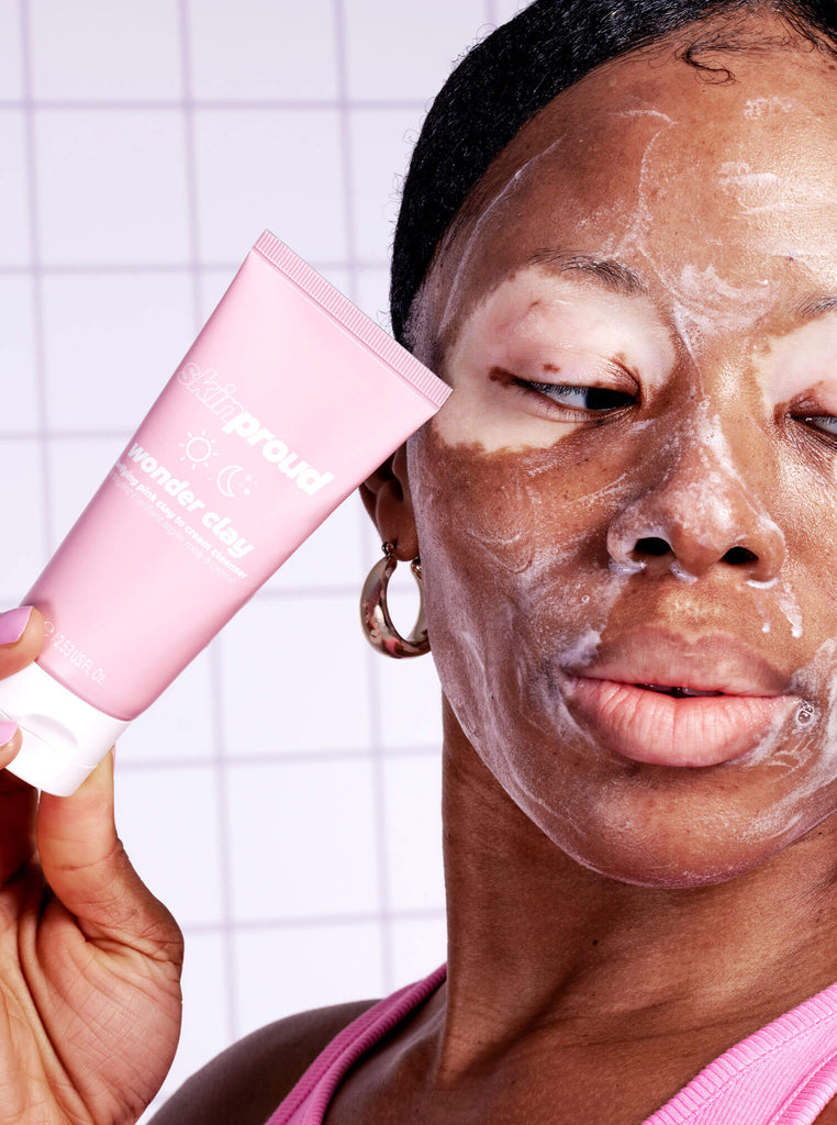 Model with vitiligo holding tube of Skin Proud Wonder Clay cleanser